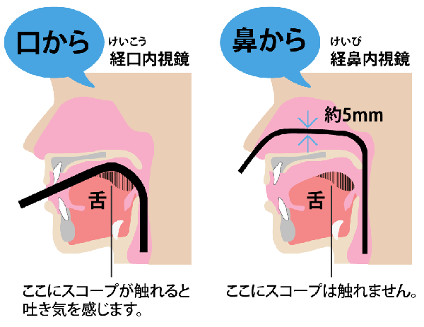 胃カメラ検査について 内視鏡検査なら足立外科胃腸内科医院 足立区青井 五反野の 外科 胃腸内科 内科