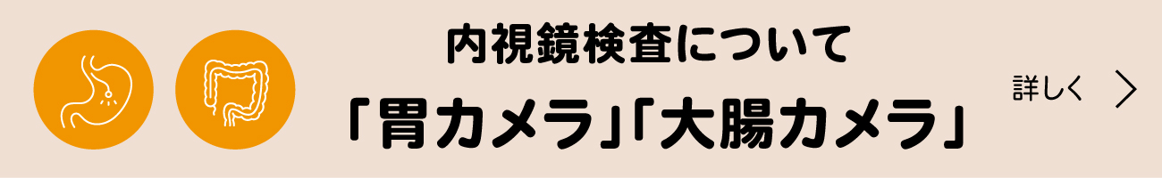 内視鏡検査　胃カメラ　大腸カメラ